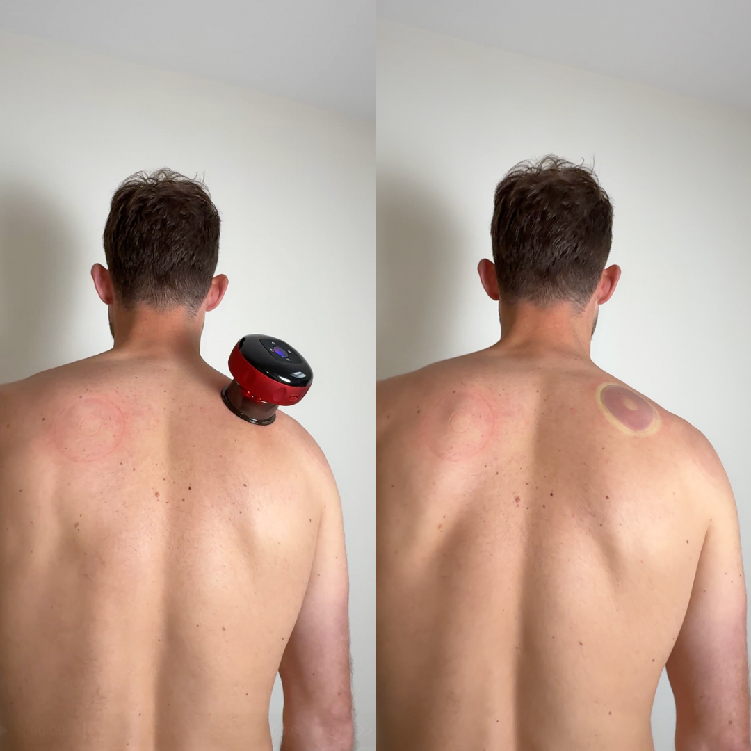 Le masseur à ventouse intelligent d'Asavya